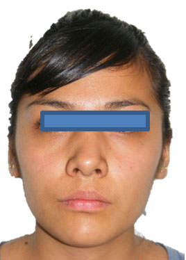 Fig. 1 De frente