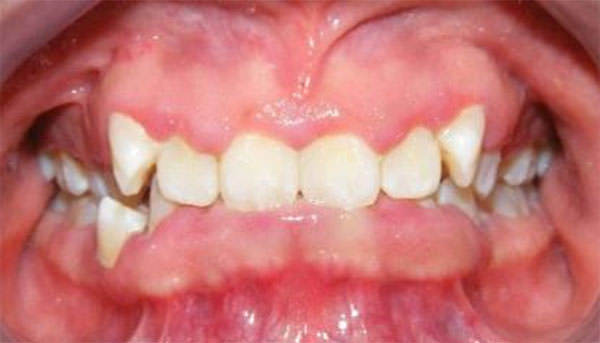 Fig. 3 Intraoral de frente