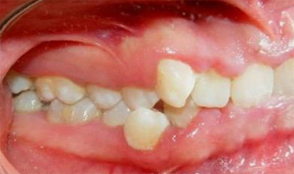 Fig. 4 Intraoral derecha