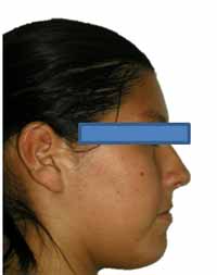 Figura 10 Perfil