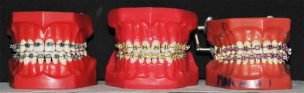 Fig. 4 Typodontos con módulos Ormco, Tp Orthodontic y Morell