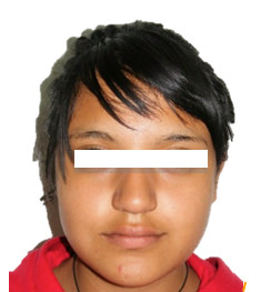Figura 1 Extraoral de frente