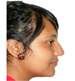 Figura 2 Perfil
