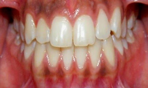 Figura 3 Intraoral de frente