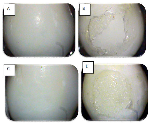 Figura. 1 Microfotografías del esmalte dentario