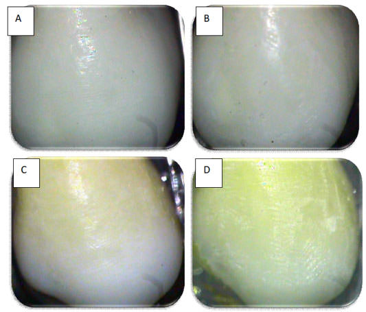 Figura. 2 Microfotografías del esmalte dental.