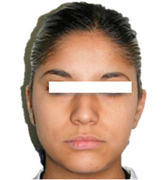 Figura 1 Extraoral de frente