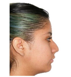 Figura 2 Perfil