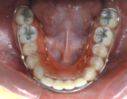 Figura 21 Oclusal inferior