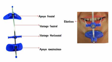 Figura 3 Imagen de Mascara Facial tipo Petit, Partes de la mascara facial.