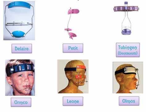 Figura 6 Imagen de los tipos de máscaras faciales.