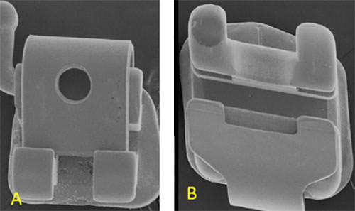 Fig.1 A., Bracket de autoligado activo. B, bracket de autoligado pasivo (Tomado de Krishnan M., Sukumaran K., Kurian M.: (2009) Comparative evaluation of frictional forces in active and passive self-ligating brackets with various archwire alloys. Am J Orthod Dentofacial Orthop; 136: 675-82