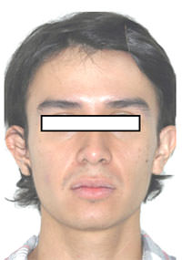 Fig. 1 Fente