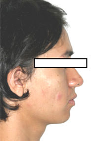 Fig. 2 Perfil
