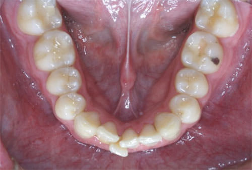 Fig. 9 Oclusal inferior