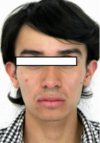 Fig. 10 Fente