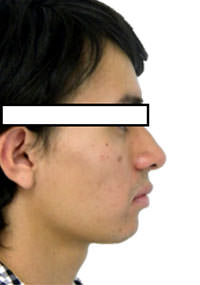 Fig. 11 Perfil