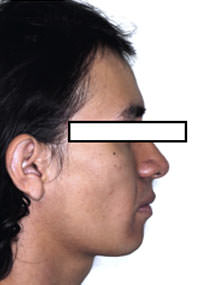 Fig. 20 Perfil