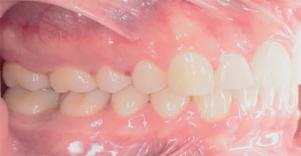Fig. 24 Lateral derecha
