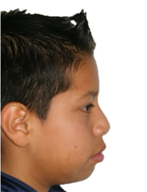 Figura 2 Perfil derecho
