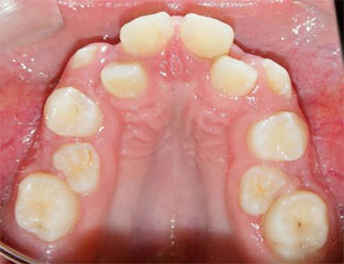 Figura 7 Oclusal Superior