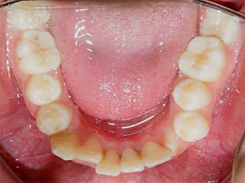 Figura 8 Oclusal Inferior