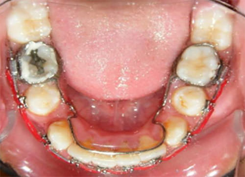 Figura 11 Oclusal inferior