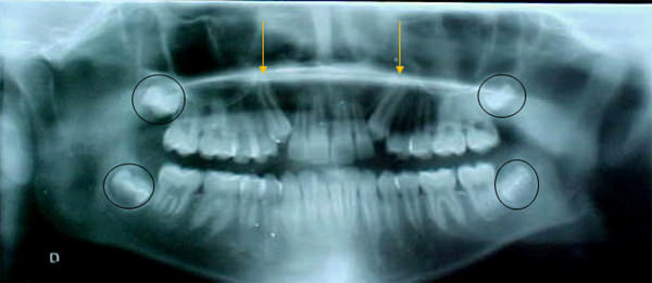 Figura 9 radiografía panorámica de inicio