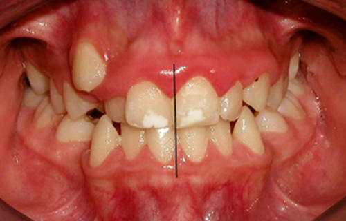 Fig. 4 Fotografía intraoral de frente