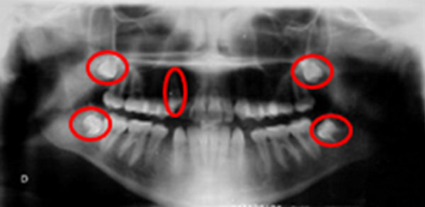Fig. 10 Radiografía panorámica