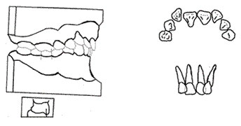 Figura Nº 7 Clase II div. 2