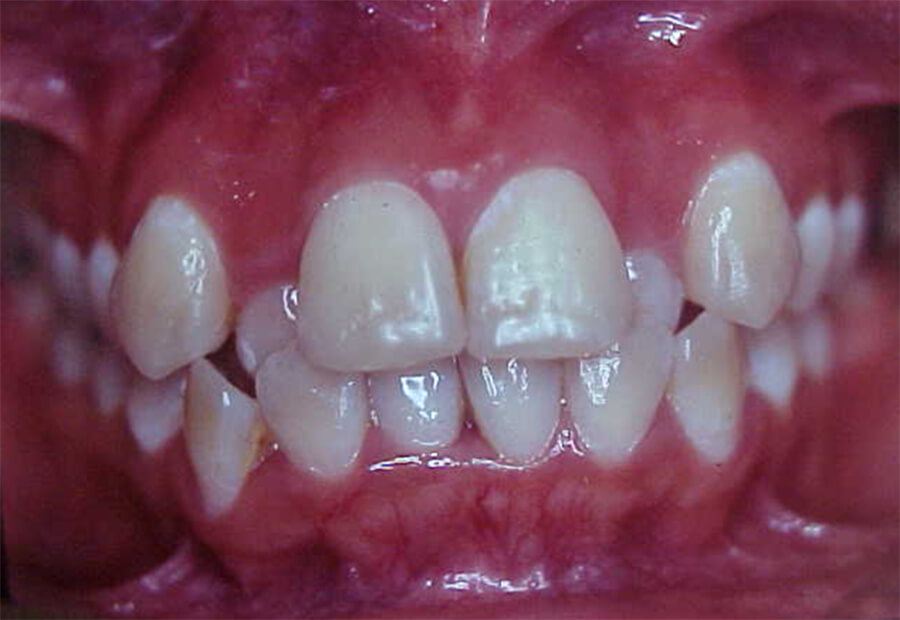 Fig. 3