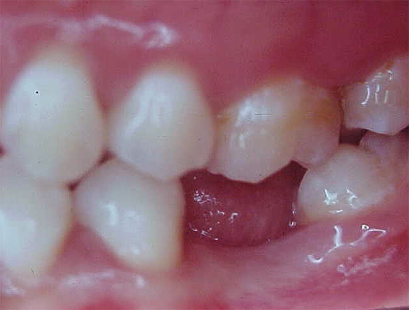 Fig. 5