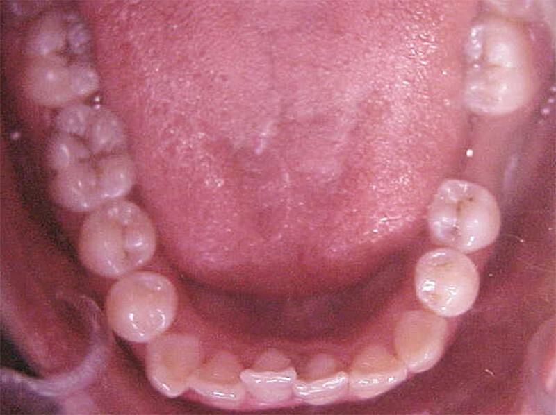 Fig. 7