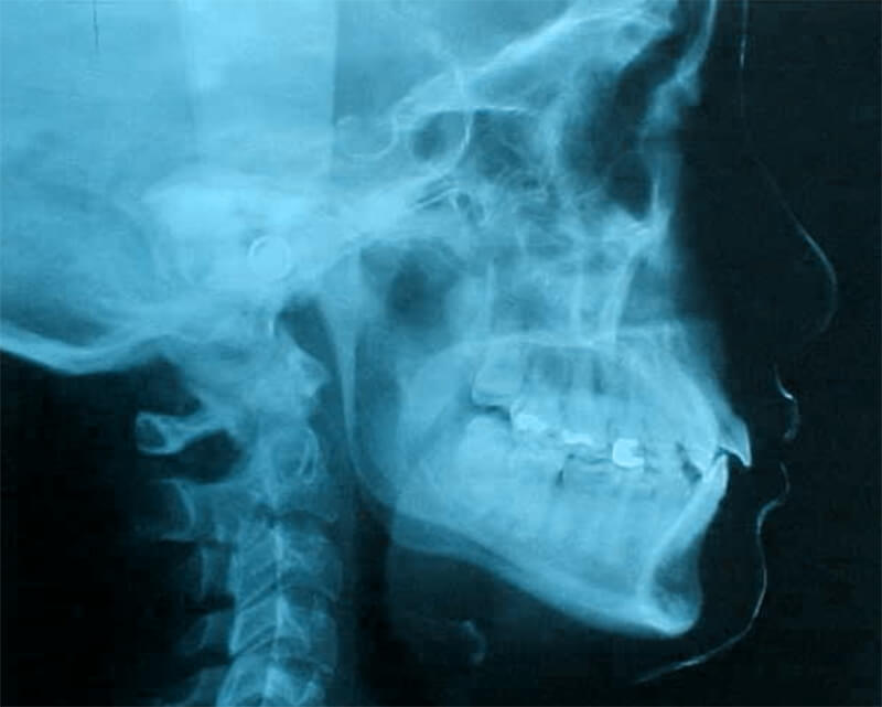 Fig. 8