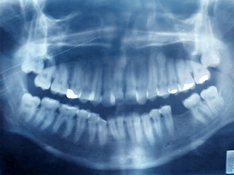 Fig. 9