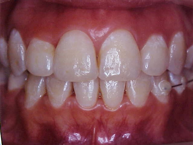 Fig. 16