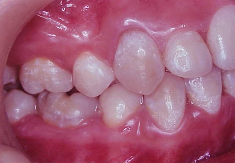 Fig. 17