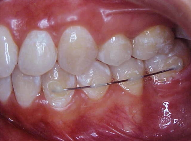 Fig. 18