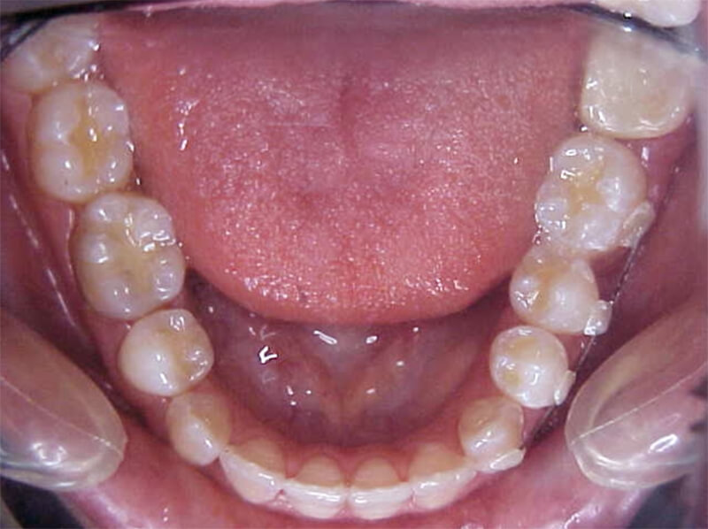 Fig. 20
