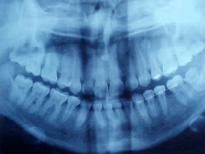 Fig. 22