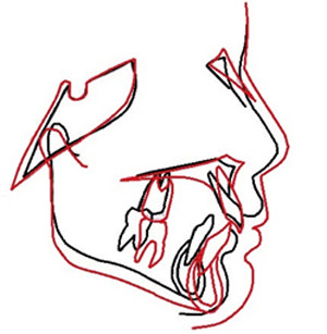 Figura 13