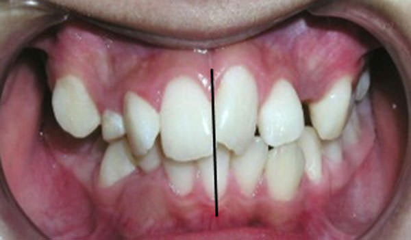 Figura 3 Intraoral de frente