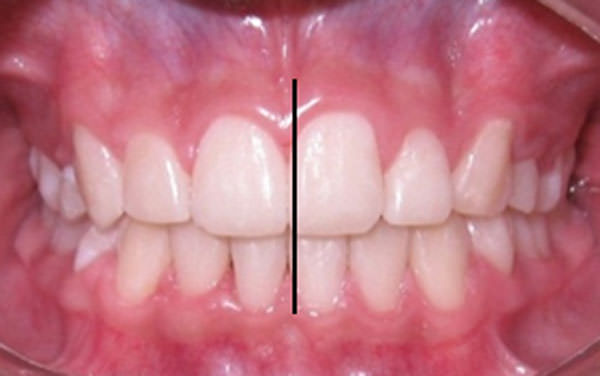 Figura 15 Intraoral de frente