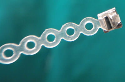 Figure 4 Elastic chain engaged from the modified bracket.