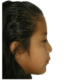 Fig. 2 Perfil