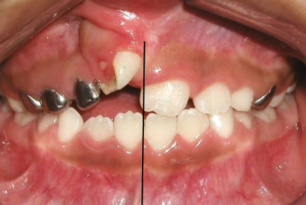 Fig. 4 Intraoral de frente 