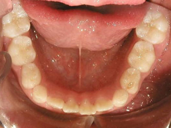 Fig. 7 Oclusal inferior