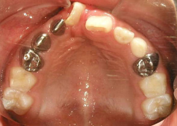 Fig. 8 Oclusal superior
