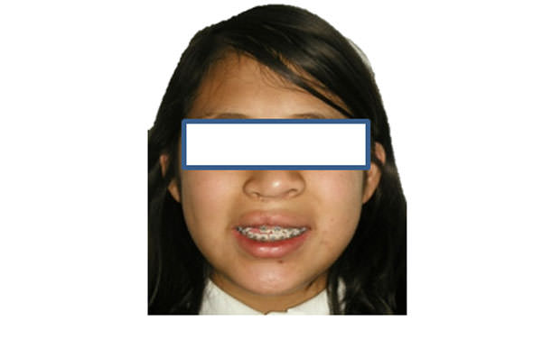 Fig. 12 Paciente frente sonrisa